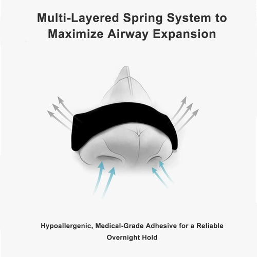 Anti Snoring Nose Strips for Breathing Correction Physical Expansion Breathable Nasal Patch Better Sleep Anti-Snoring Nasal Stri